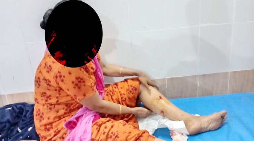 মতলব উত্তরে কুকুর আতঙ্কে এলাকাবাসী, আহত ৩৬