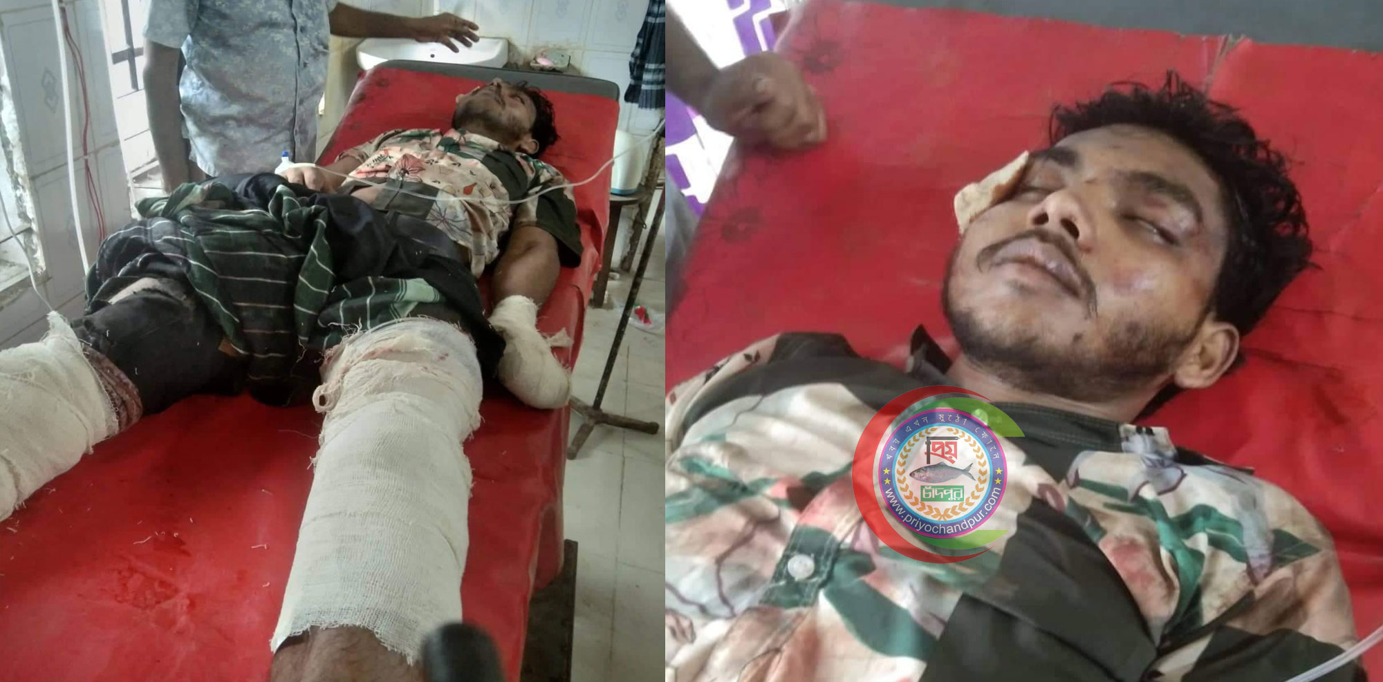 শাহরাস্তিতে হেডফোনে গান শুনতে গিয়ে ট্রেনের ছাদ থেকে পড়ে যুবক জীবন-মৃত্যুর সন্ধিক্ষণে