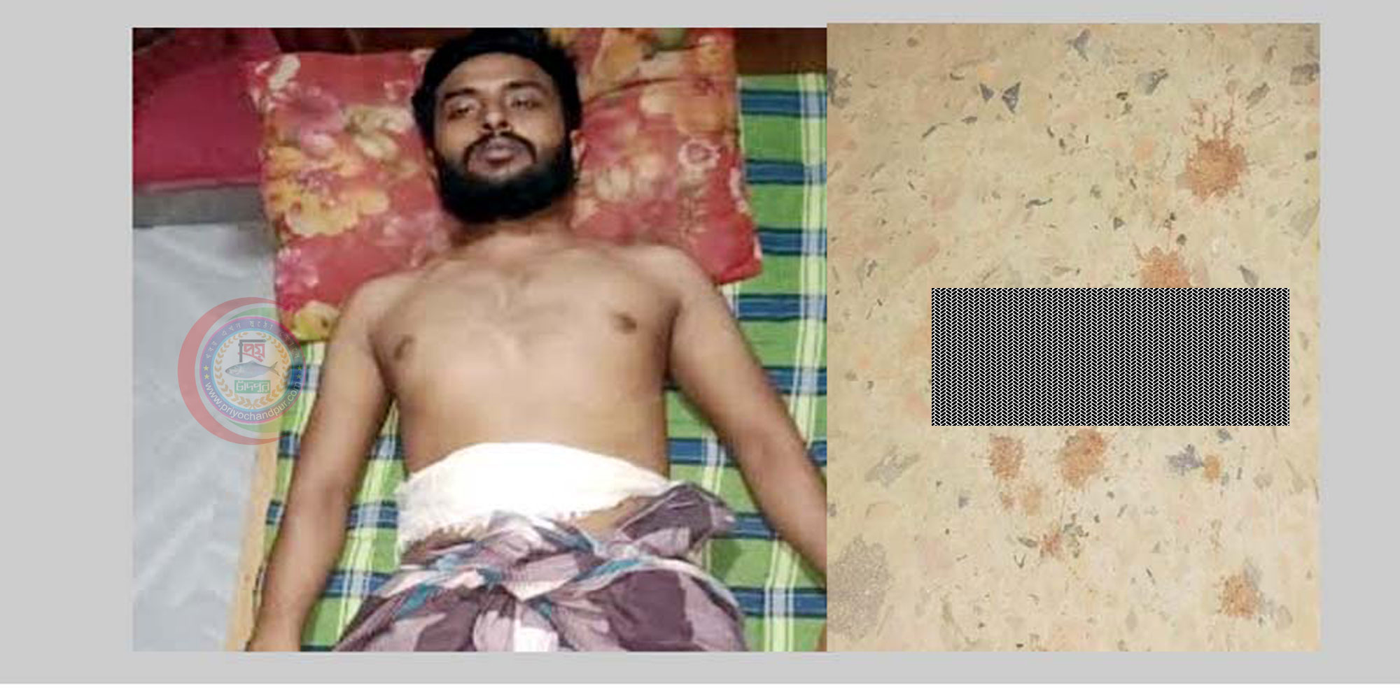 ফরিদগঞ্জে ছুরিকাঘাতে যুবক আহত