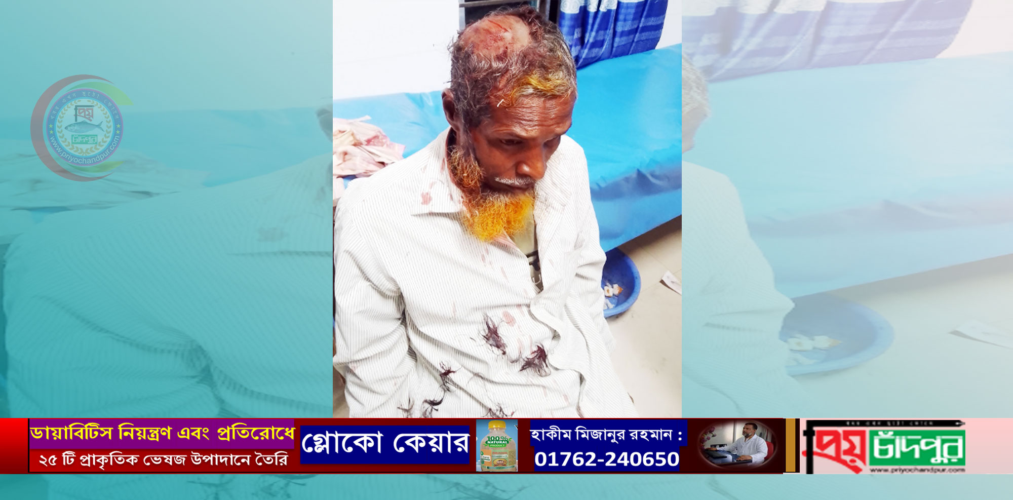 মতলব উত্তরে পৈতৃক সম্পত্তিগত বিরোধে বড় ভাইকে পিটিয়ে জখম