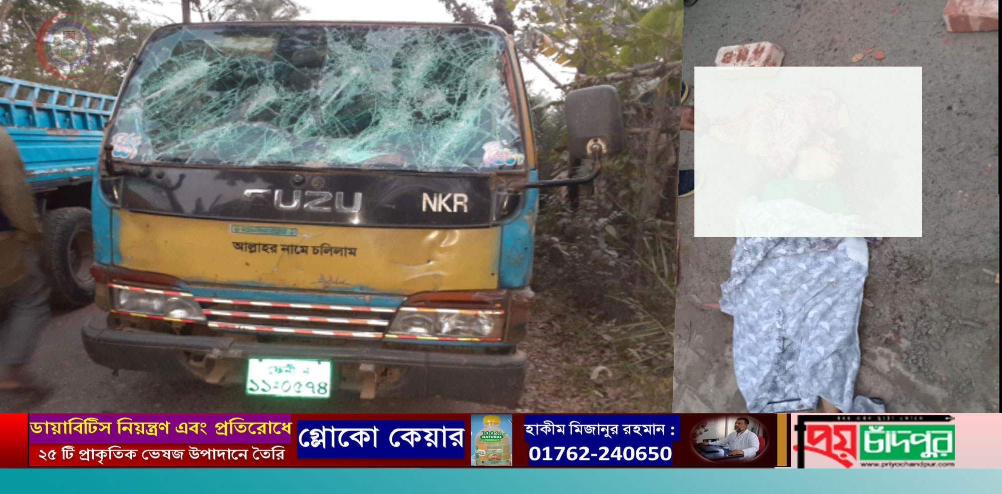 শাহরাস্তিতে ইটা বোঝাই পিকআপের চাপায় শিশুর মৃত্যু