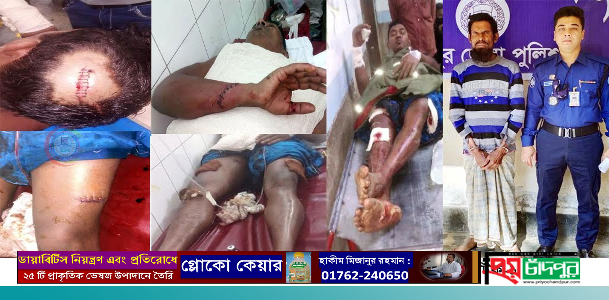 ফরিদগঞ্জে যুবককে কুপিয়ে যখম, আটক-১
