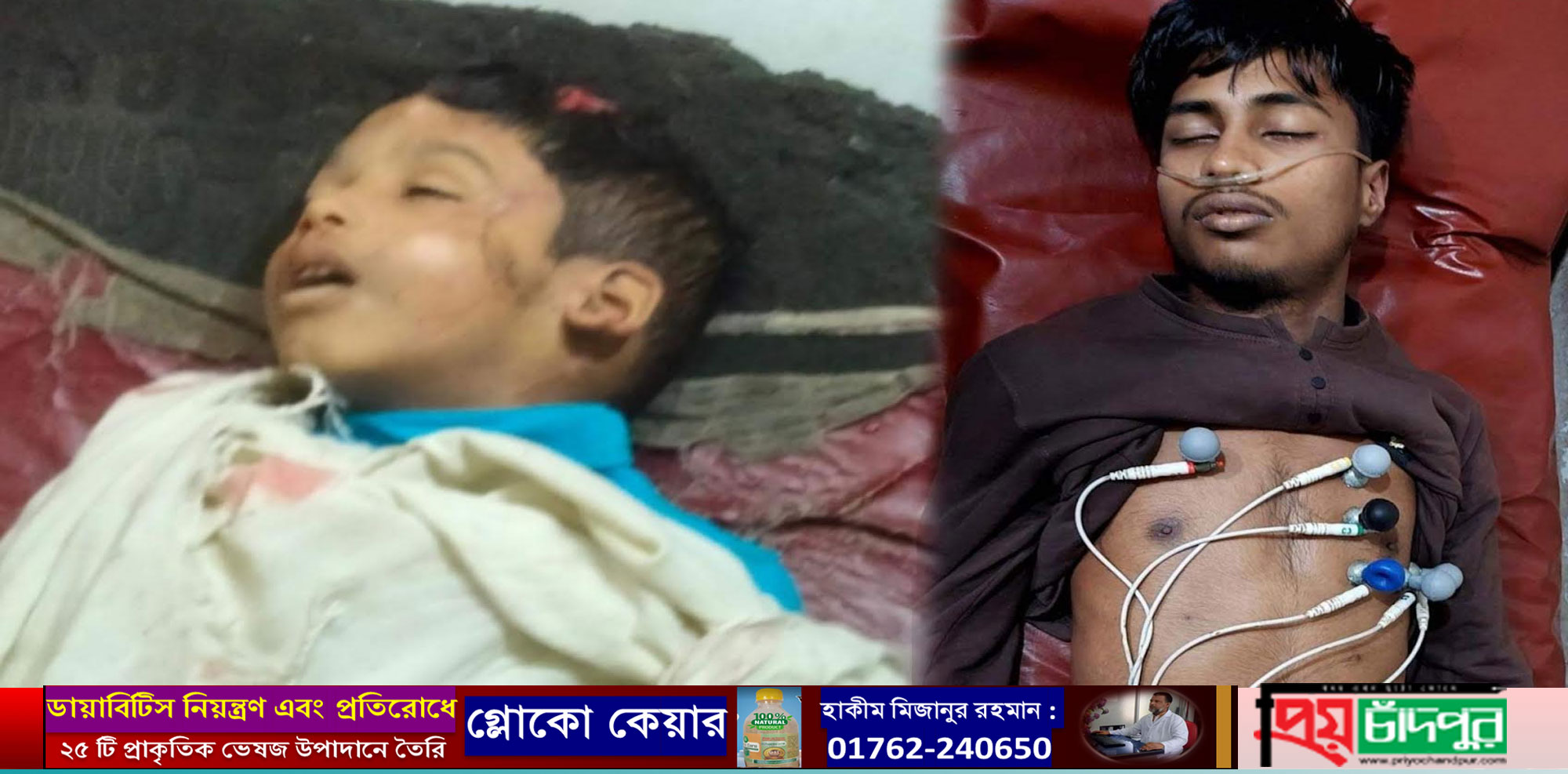 হাইমচরে সড়ক দূুর্ঘটনায় শিশু নিহত ও আরেক কিশোরের গলায় ফাঁস দিয়ে আত্মহত্যা