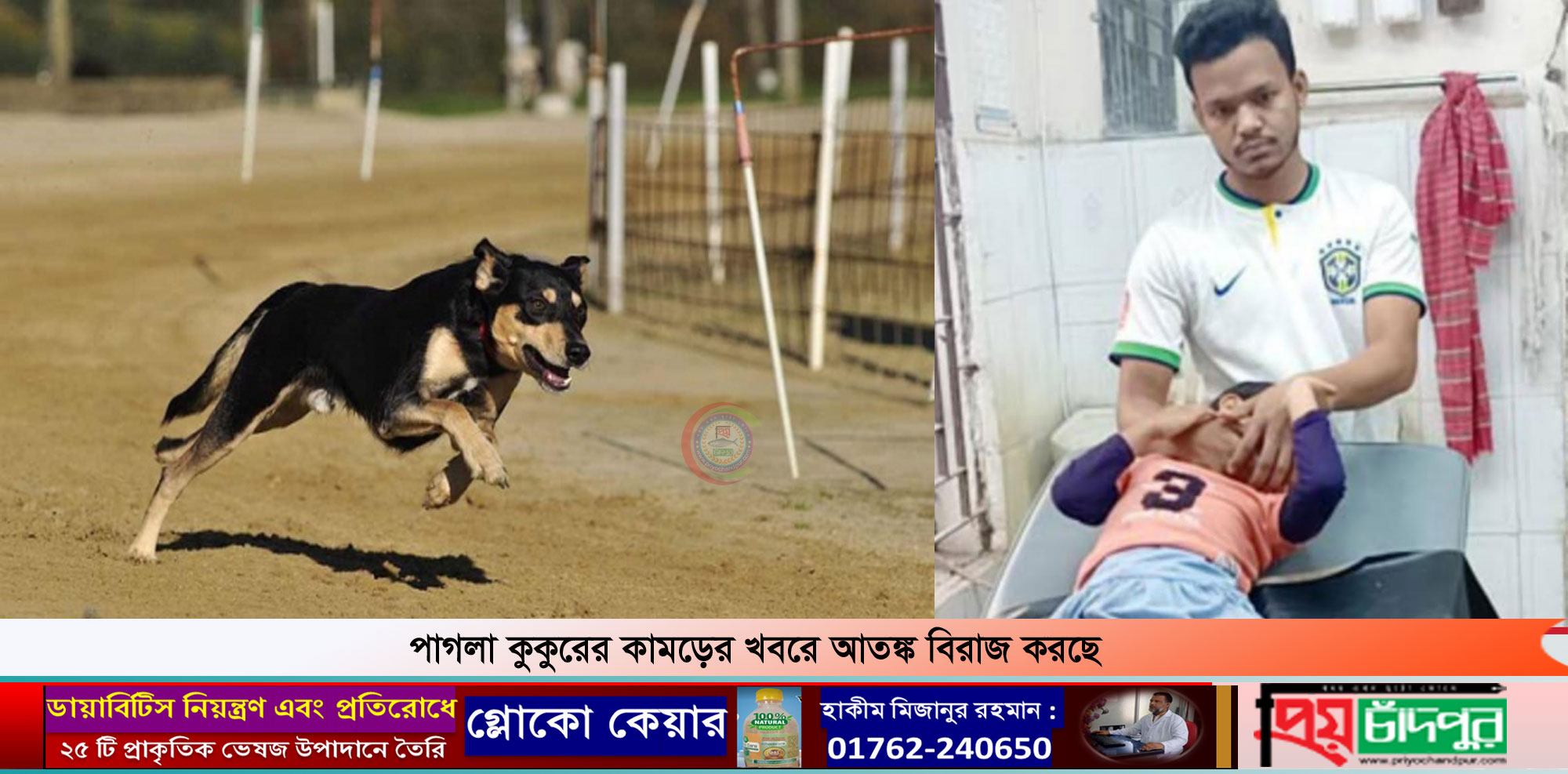 শাহরাস্তিতে পাগলা কুকুরের কামড়ে ২দিনে ১০শিশুসহ আহত ১২