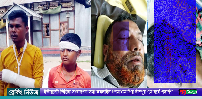 মতলব উত্তরের চরউমেদে দুই গ্রুপের দ্বন্দ্বে গুরুতর আহত ৪
