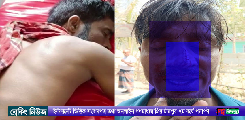 কচুয়ার উজানী গ্রামে পূর্ব শত্রুতার জেরে হামলায় আহত ৩, গ্রেফতার-১