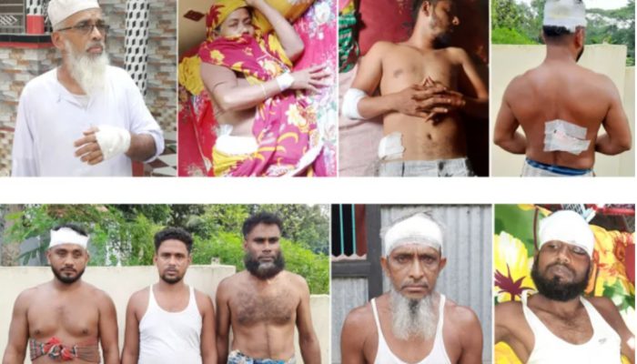 চান্দিনায় ১১ জনকে কুপিয়ে পালাল ডাকাতদল