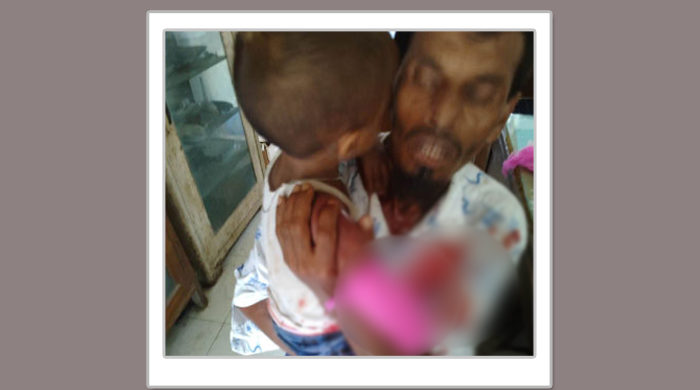চিড়িয়াখানায় হায়েনার কামড়ে শিশুর কব্জি বিচ্ছিন্ন