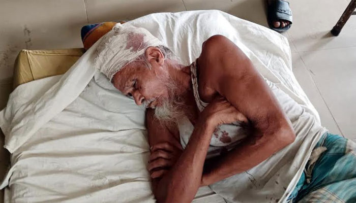 চোরকে চোর বলায় বৃদ্ধকে পিটিয়ে রক্তাক্ত জখম