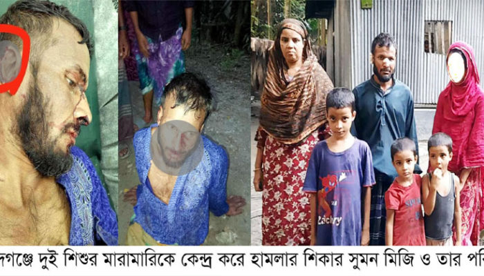 ফরিদগঞ্জে দুই শিশুর মারামারিকে কেন্দ্র করে অসহায় পরিবারের ওপর সন্ত্রাসী হামলা