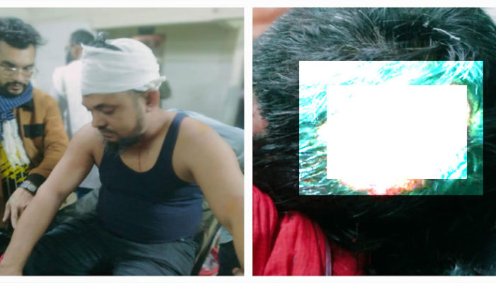 মতলব উত্তরে ঈগল প্রতীকের মিছিলে নৌকার সমর্থকদের হামলা : আহত ৫