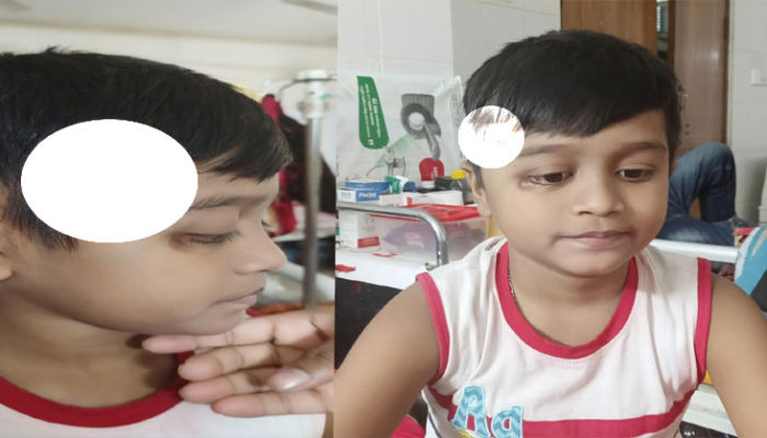 বাচঁতে চায় ২য় শ্রেণির শিশু শিক্ষার্থী শুভ