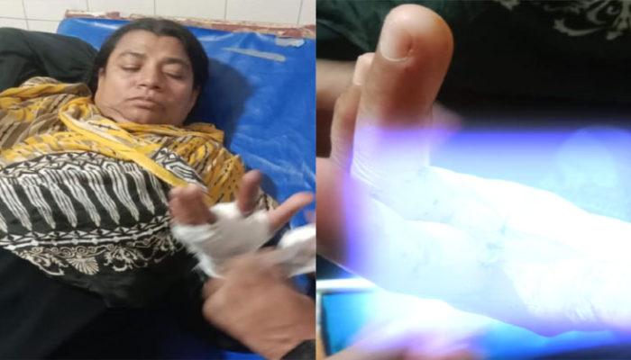 মৈশাদীতে তুচ্ছ ঘটনায় বিধবার উপর হামলা