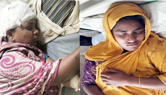কচুয়ায় মা-মেয়ের উপর হামলার অভিযোগ