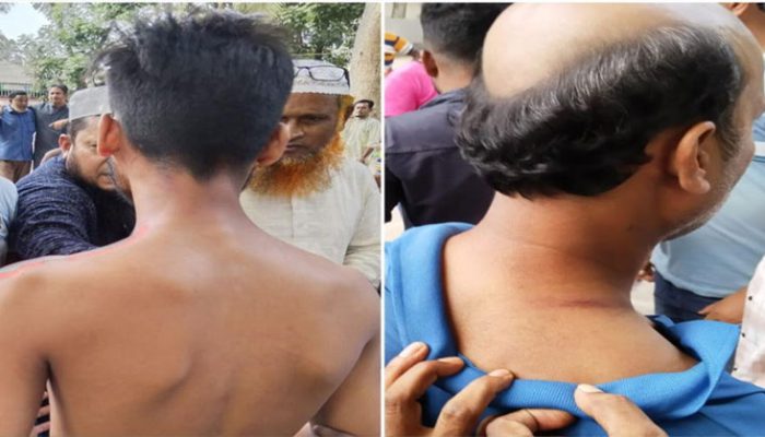 কচুয়ায় প্রাণ কোম্পানির প্রতিনিধির উপর হামলা