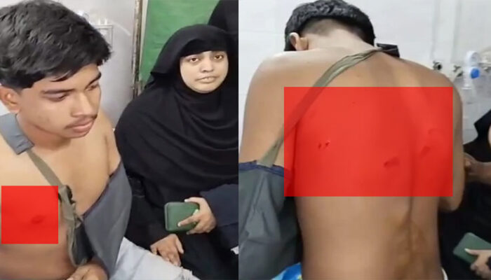 কিশোর গ্যাংয়ের হামলায় চাঁদপুর আল আমিনের অষ্টম শ্রেণীর ছাত্র গুরুতর আহত