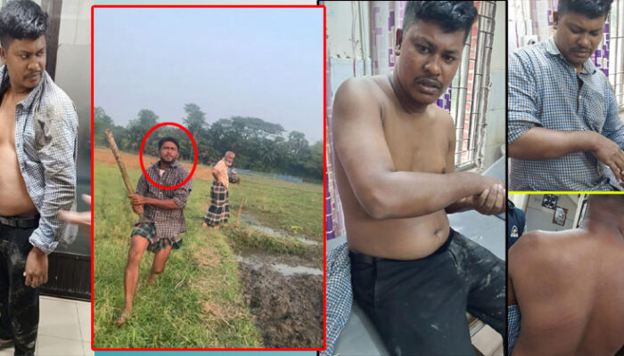 জমির সীমানা বিরোধের জেরে ইউনিয়ন ছাত্রদল সভাপতির উপর স’ন্ত্রা’সী হা’ম’লা