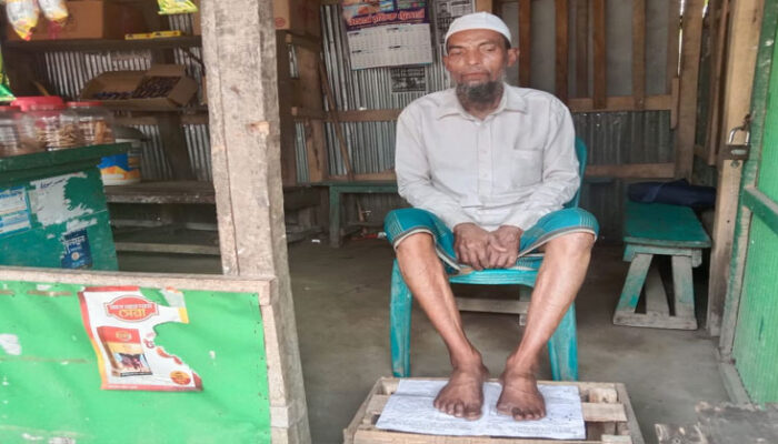 চিকিৎসায় যাচ্ছে ভিটেমাটি, গ্যাংগ্ৰিনে আক্রান্ত সিদ্দিক বেঁচে থাকতে চায়