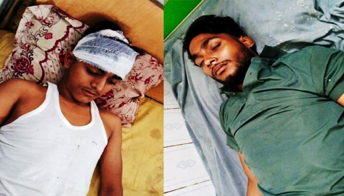 কচুয়ায় পাল্টাপাল্টি হামলায় আহত-২