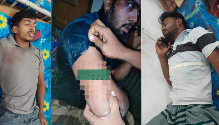 হাজীগঞ্জের পদুয়ায় মাদকের বিরুদ্ধে দাঁড়ানোয় তিন যুবক রক্তাক্ত!
