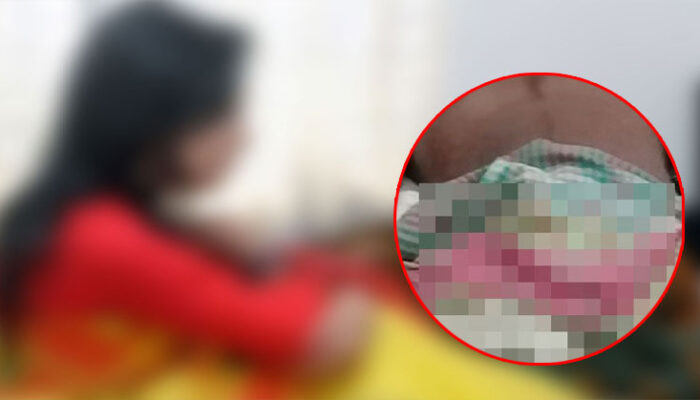 চাঁদপুরে ঘুমন্ত স্বামীর স্পর্শকাতর অঙ্গ ‘কে টে পালালেন স্ত্রী’