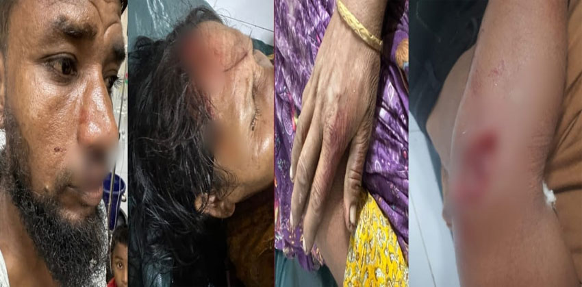 মতলবে লিফলেট বিতরণকালে আওয়ামী লীগ নেতাদের হামলায় বিএনপির ৫ নেতা আহত