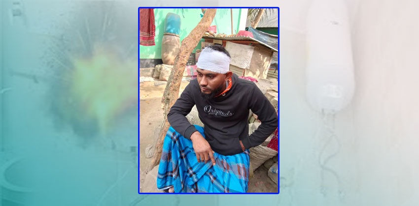 ফরিদগঞ্জে পানির গিজার বিস্ফোরণে আহত-২