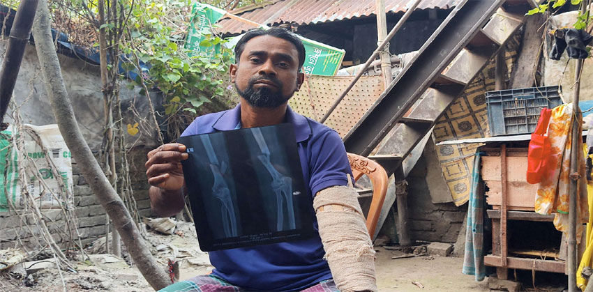 টাকার অভাবে চিকিৎসা বন্ধ দিনমজুর জাকিরের, প্রয়োজন এক লাখ টাকা