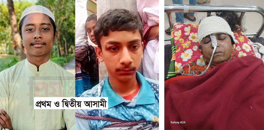 কচুয়ায় চোরের হামলায় আহত প্রবাসীর স্ত্রীর ১৯ দিন পর মৃত্যু