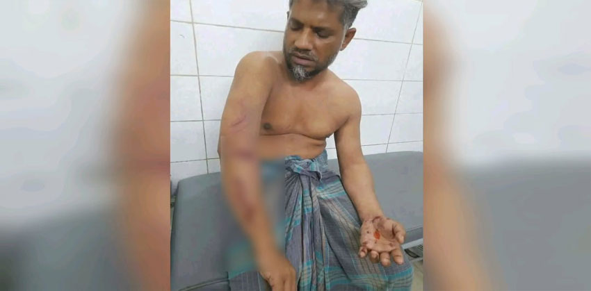 ফরিদগঞ্জে ইউপি সদস্য অপহরণ, আটকে রেখে নির্যাতন