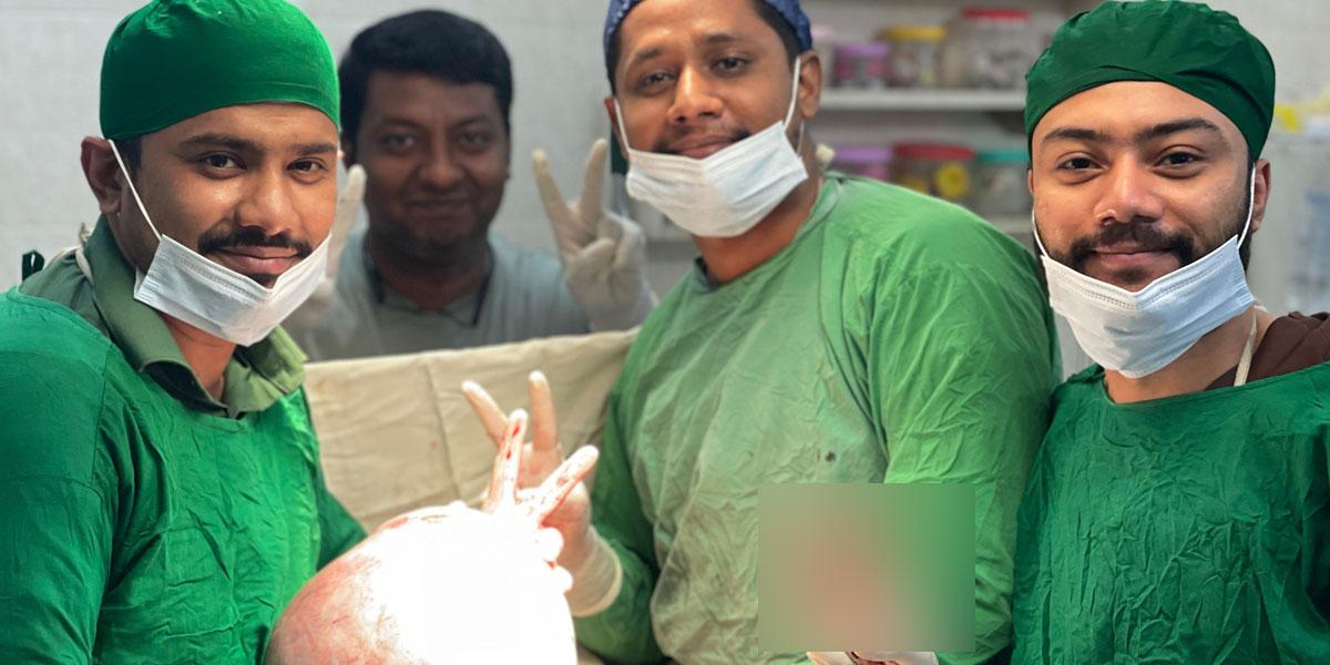 শাহরাস্তিতে চাঞ্চল্য, নারীর পেট থেকে বের হলো ৮ কেজির টিউমার