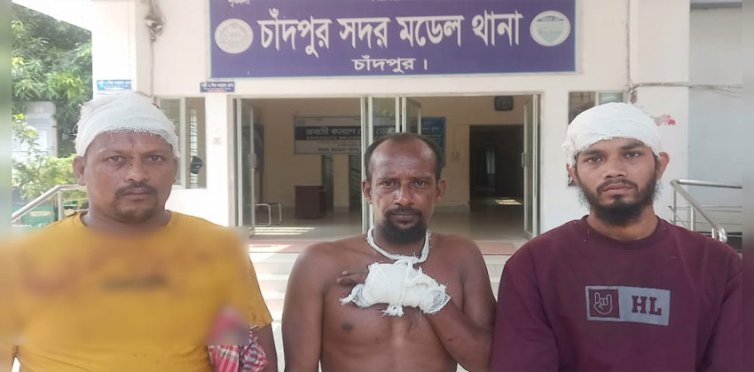 রাস্তা নিয়ে বিরোধ সংঘর্ষে চাঁদপুর সদরে একই পরিবারের ৩ জন জখম