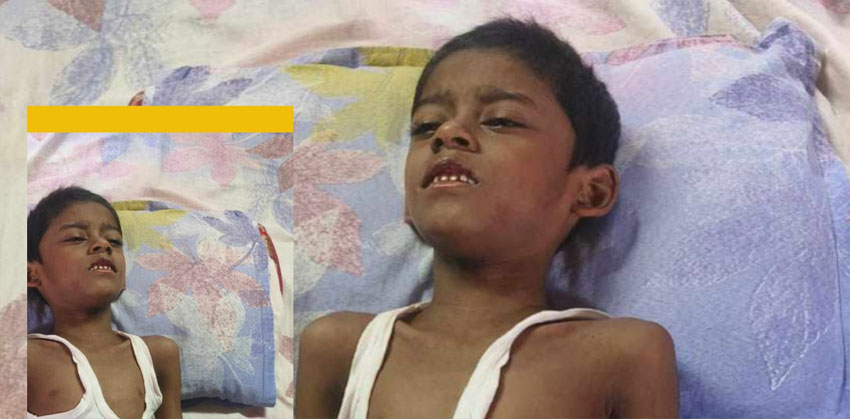 সাহায্যের আকুল আবেদন: বাঁচতে চায় ছোট্ট রহিম