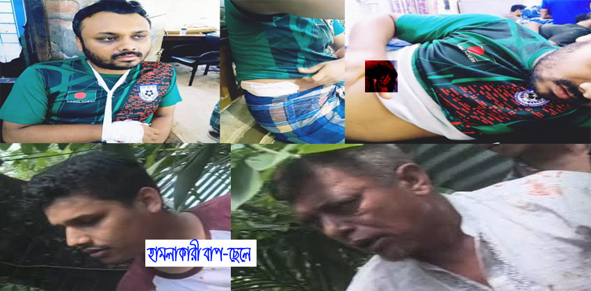 শাহরাস্তিতে সাংবাদিক হামজাকে কুপিয়ে জখম, স্ত্রীকে শ্লীলতাহানির অভিযোগ