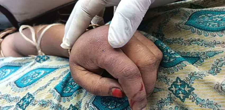 বর্ষায় বাড়ছে সাপের উপদ্রব, হাজীগঞ্জে সাপের ছোবলে প্রাণ গেল গৃহবধূর