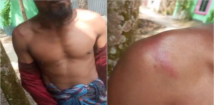 চাঁদপুর সদরের চান্দ্রা বাজারে গাছকাটার শ্রমিককে বেদম পেটানোর অভিযোগ